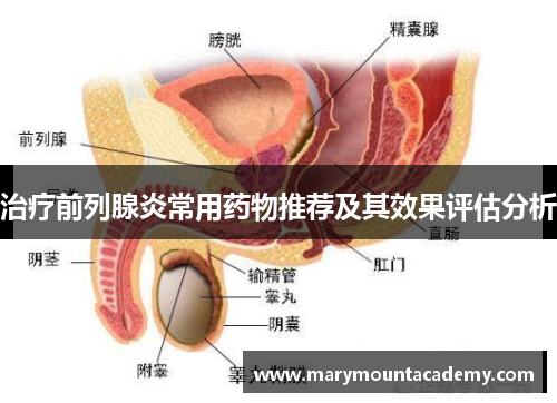 治疗前列腺炎常用药物推荐及其效果评估分析